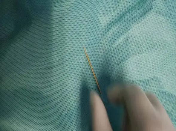 喝水|小伙含着牙签喝水，一不小心吞进肚里致胃穿孔