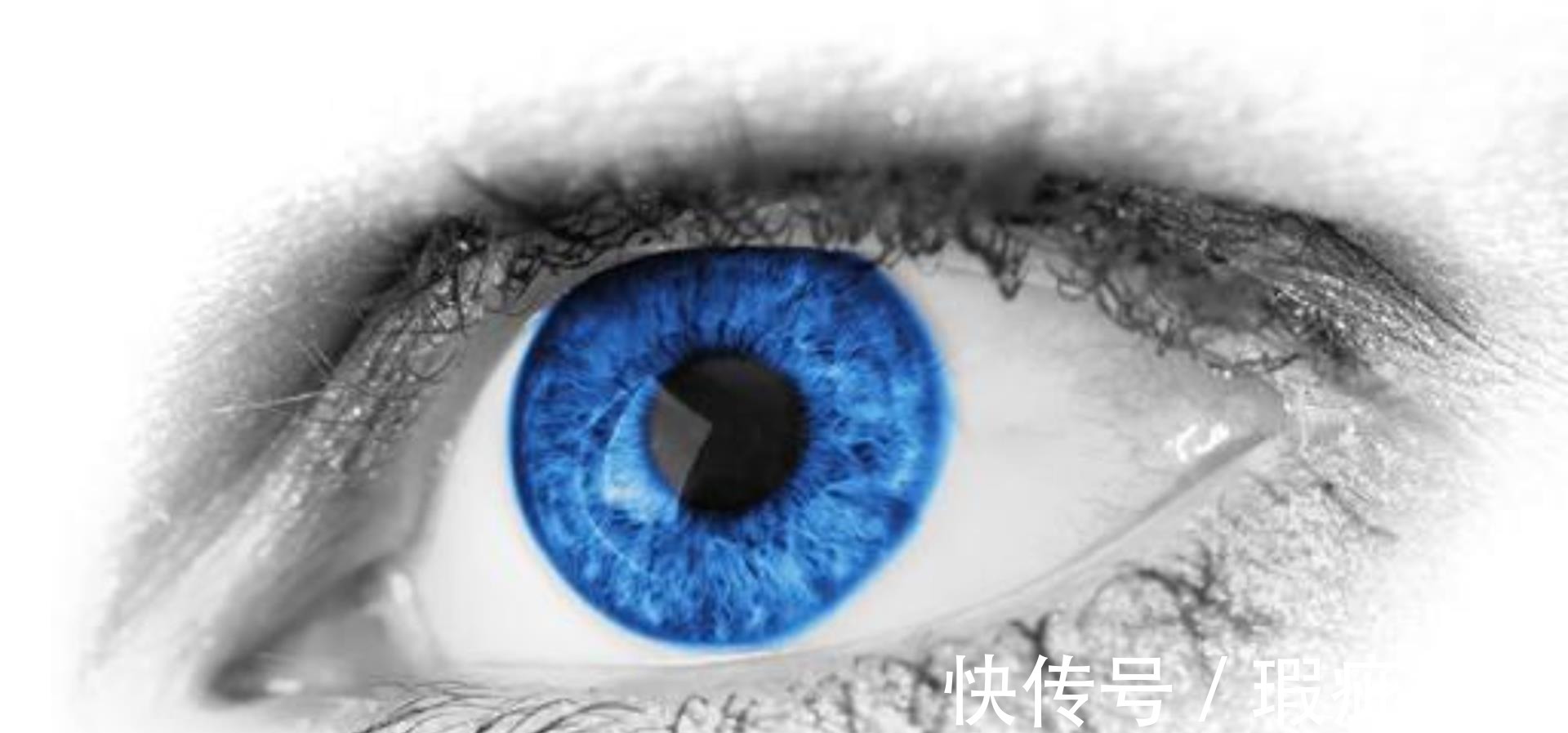 手术治疗|微型镜片植入手术是什么？1000度近视恢复1.0视力，近视眼有救了