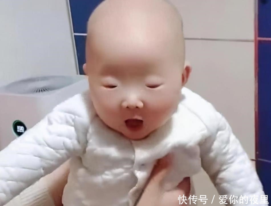 宝宝|宝宝出生“豆豆眼”急坏妈妈,送医检查后医生却笑了:是你想多了