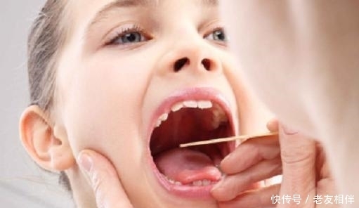 情况|当舌苔出现这5种情况时,暗示你将“疾病缠身”,需警惕!