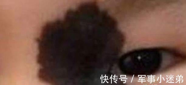 宝宝|若不想让宝宝留下胎记,孕期就别太任性,尽量不要有这4种行为