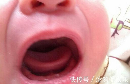 马牙|宝宝出生一个月后意外得了败血症,妈妈后悔当初为什么要听婆婆话