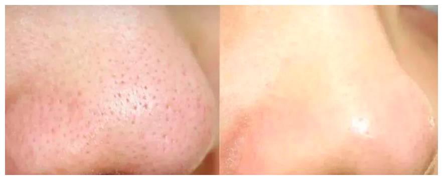 你其实还不会洗脸