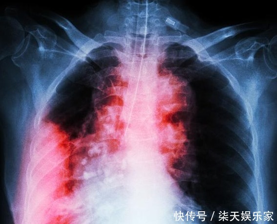 从肺癌、结肠癌到痊愈，谨记1句话，多吃2种菜，让身体健康长寿！