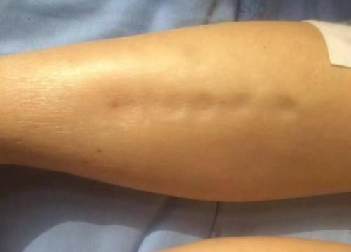 黃芪泡水，切記“5不5必”喝，喝對了養生，喝錯了有傷害，記清楚