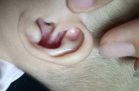 家长们|“妈妈，耳朵好痒”，家长拿手电一照，差点出一身汗