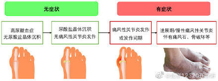 慢性间质性肾炎|高尿酸血症 离痛风只差几步