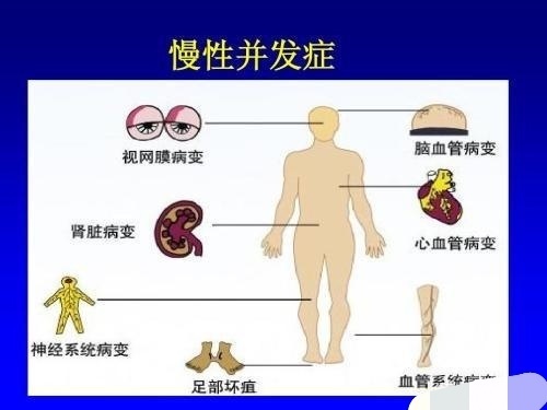 木糖醇|糖尿病人不能吃甜的东西吗得了糖尿病，和甜的东西算是告别了