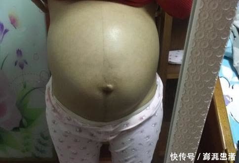 脐带|脐带绕颈后,准妈妈要做到一点,有利于自然绕出