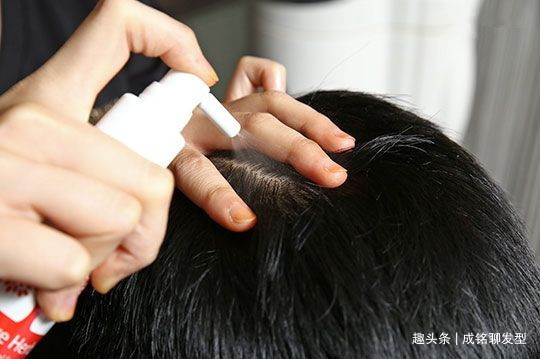 头皮 经常染发的老年人,要养成这三个养护好习惯,头皮健康不伤发