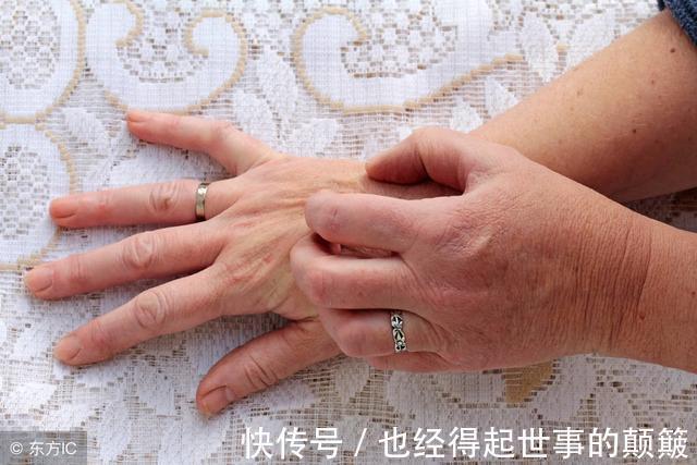 胰岛细胞|研究发现新的糖尿病因!医生提醒反复出现这1现象需警惕糖尿病