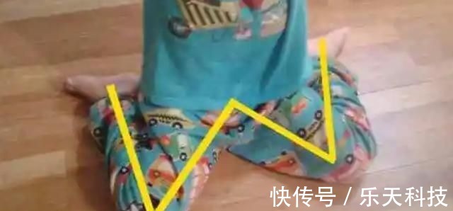 孩子|8岁男孩脊椎侧弯,只因家人常做这个动作,这个错误,90%的父母都在犯