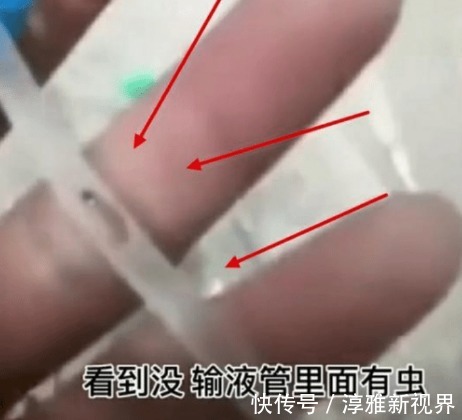 输液管|3岁幼童输液,输液管里惊现虫子,爸爸都输进我娃身体里了