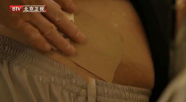 复发|查出这类结节、息肉,再小也别忽视!中医平肝健脾,消结节、除息肉,化解肿瘤危机防复发