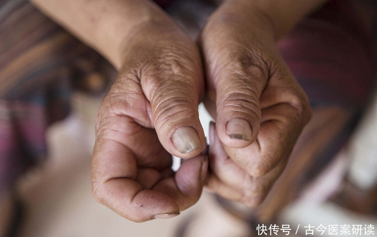 风湿|桑树的嫩枝条,是一味常用的中药,可用于高血压、风湿类风湿