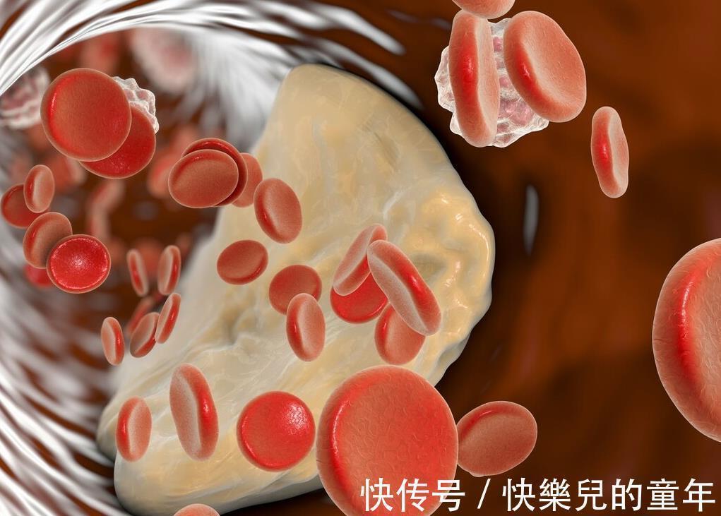 老爷子|102岁长寿老人，年轻像60岁，秘诀不是多运动，而是这3件事