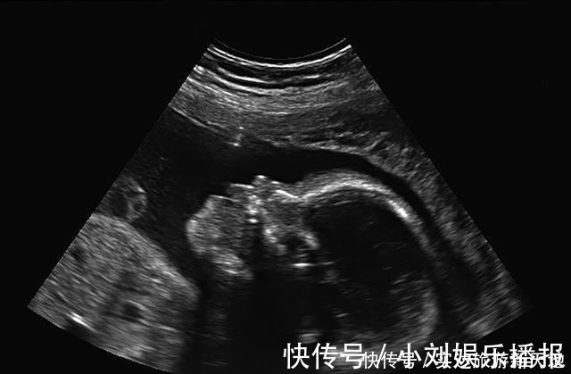 B超单|孕期B超单直接反应胎儿状况,这5处孕妈要学会看懂,医生不会详说