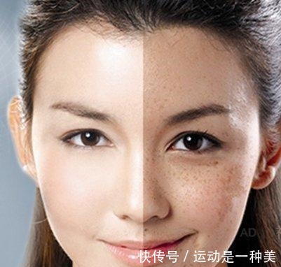 香馍馍|药店有一种司空见惯的面霜,被当作“香馍馍”,用后斑点慢慢消失!