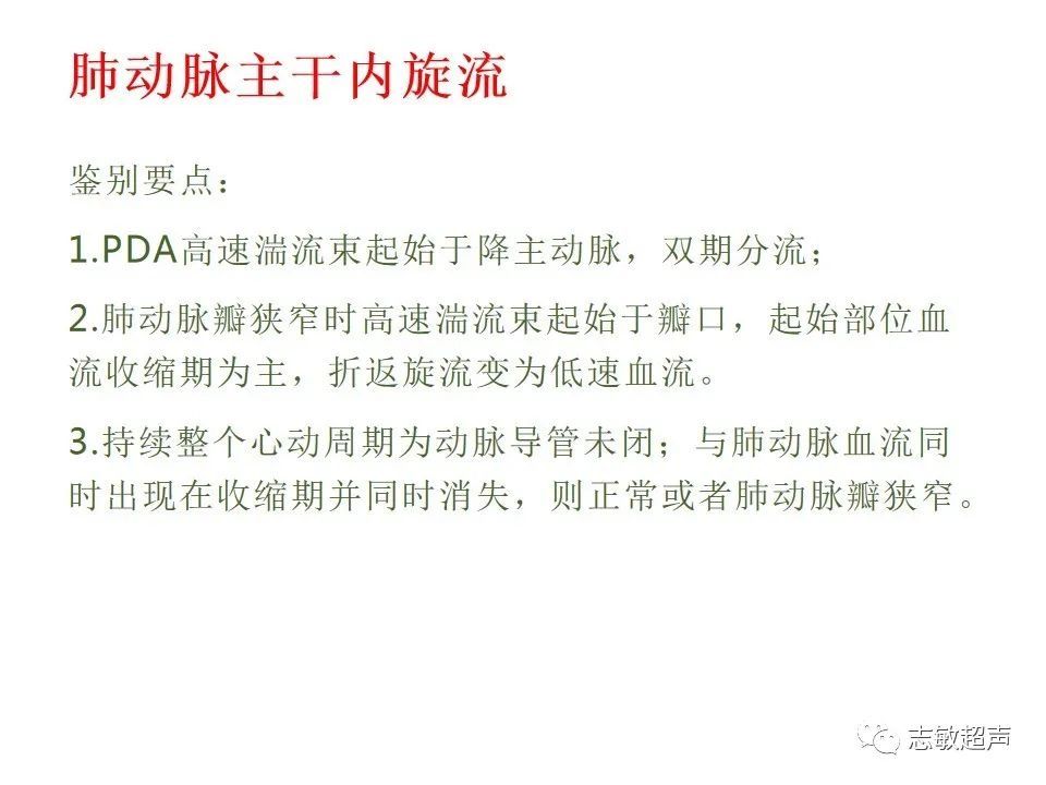 超声|肺动脉瓣周边异常血流的超声鉴别