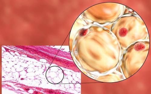 肌肉|坚持2个月,每天跑步45分钟,为什么肉变软了人没瘦?方向错了