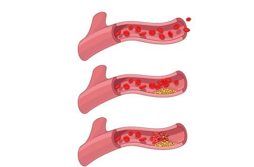 胜过|吃一口胜过8斤菠菜，心内科医生：你若爱吃，降脂溶栓，脑梗＂不敢造次＂