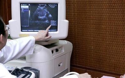 医生|为啥产检不允许家属陪同?不是医生有事瞒你,而是出于4方面考虑