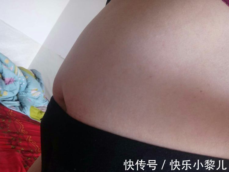 孕妈|孕期有多少“奇葩反应”?肿胀、长毛都是小问题,这个才让人头疼