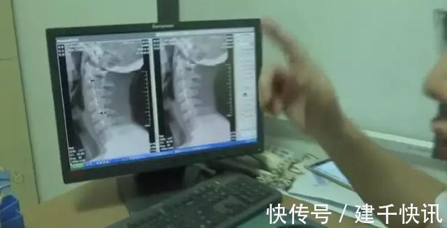 孩子|一年来男孩一直做一件事,妈妈发现后立刻送医,医生却说来晚了