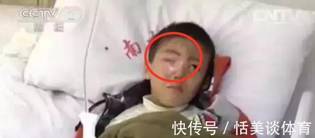 毯子|20分钟男孩眼珠被“熔化”，家长们都该敲响警钟，家庭安全别大意