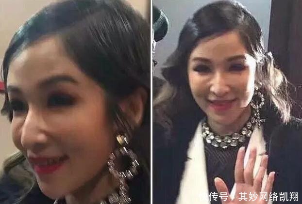 垮掉|明星都爱打玻尿酸, 但你一定没看过她们脸垮掉的样子