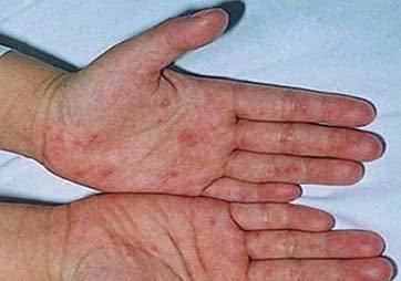 肝癌早期的4个信号, 不要忽视了, 抓住一个或许可以保命