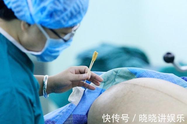 妈妈|剖腹产原来有那么多的隐患,孕妈要早知道,能顺产就别剖