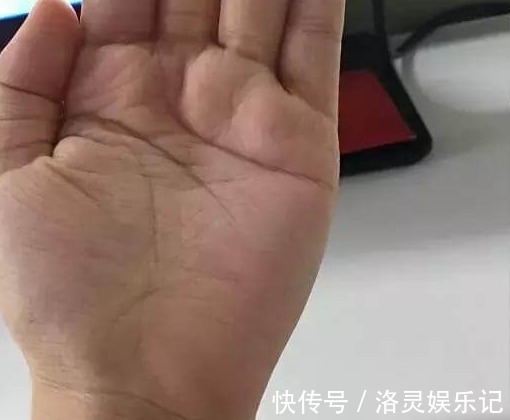 横线|此条糖尿病线，你手上有没有？如果看到，劝你多留个心眼！