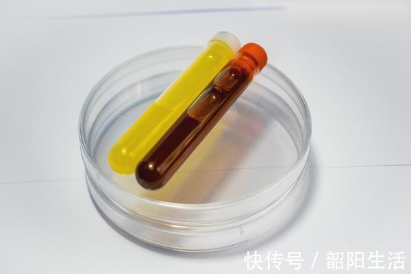 血脂异常|高血脂的人有5种“变化”,不想血管堵塞,希望你尽快忌口