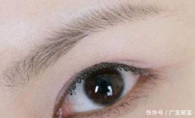 双眼皮|双眼皮手术费用多少关于双眼皮医院不会告诉你的这些事