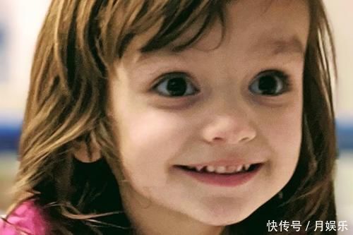 莱利|2岁女孩总发烧家人以为是感冒,送进医院却被立即截去双腿