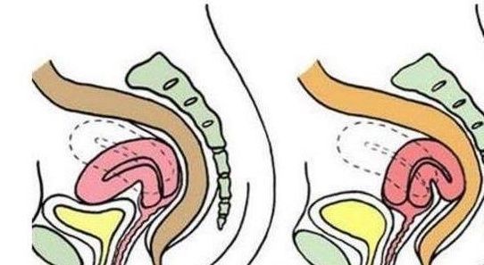 孕妇|孕期，上怀和下怀，对胎儿来说有什么区别？看完你就知道了！
