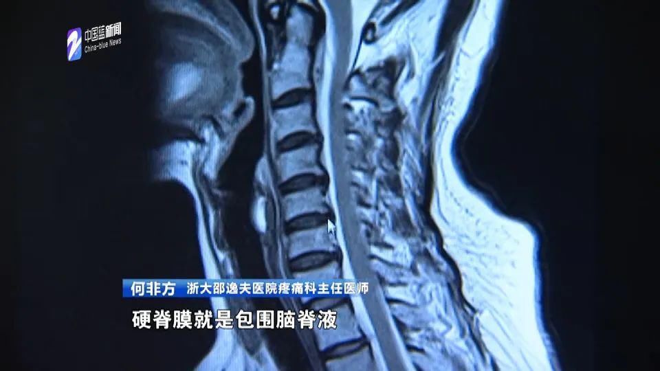 浙大|经常玩手机、这些情况下头疼，小心！你可能“脑子进水”了