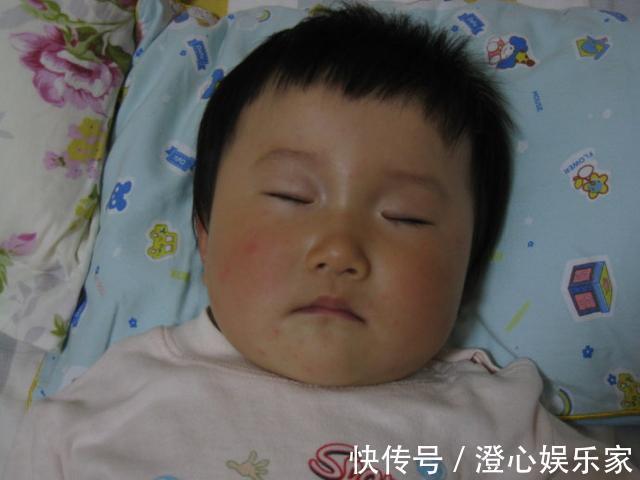 护理|宝宝出现9个特点,可能是患急疹了,教你5个方法,在家就能护理