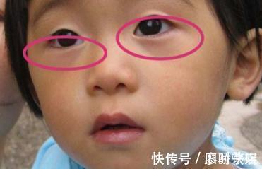 郑姐|吃一次7天不消化,很多父母天天喂娃吃,儿科主任溺爱毁掉孩子