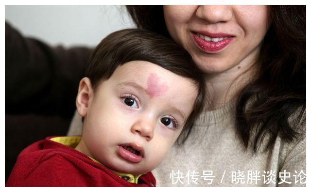 小女孩|宝宝的胎记怎么来的?产科医生:孕期这2种行为易长胎记,要避开