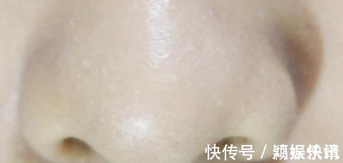 毛鼻毛|为啥鼻毛长着长着,就会“窜”出来 鼻毛过于旺盛,说明了啥