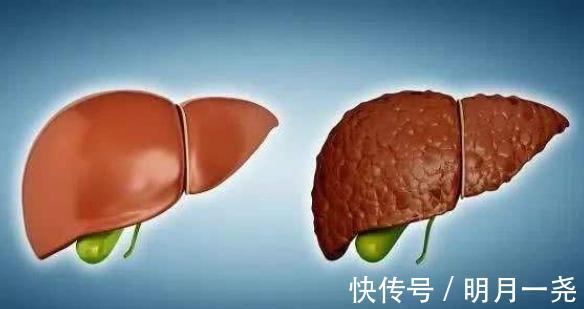 饮酒|糖尿病人究竟能不能喝酒,危害大不大看完或许能明白