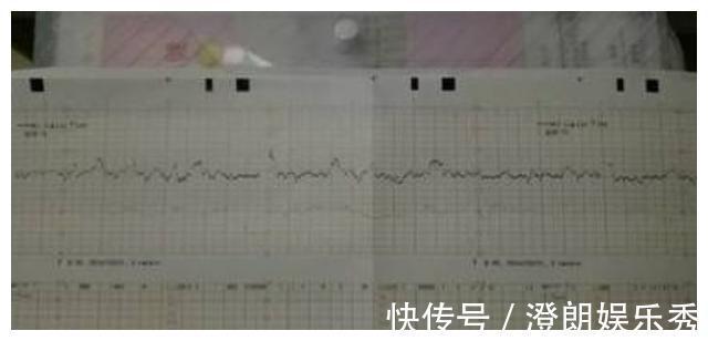 股骨长|孕检时，若怀的是男宝宝，多数会有这3种孕检结果，你都符合吗？