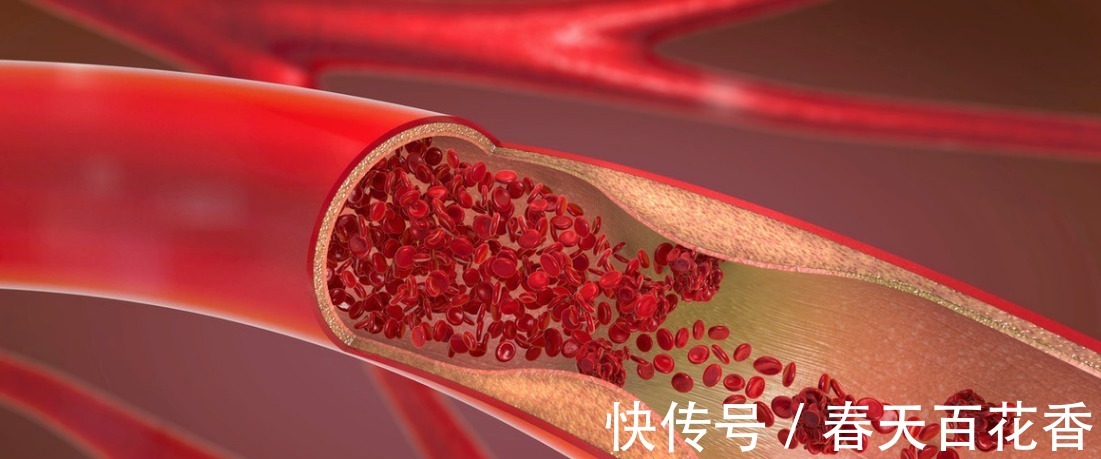 strong|三甲主任:开水里放1勺,喝上15天,血脂降了、人精神了,防血栓