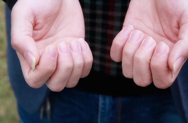 更年期|女性45岁以后,身体三处变的越来越薄,恭喜你是“老得慢”体质