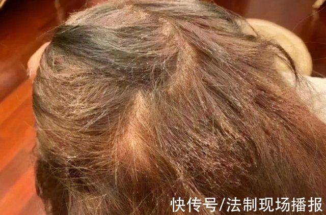 管女士 “我丑得出不了门!”女大学生花1000块染发变成这副模样:赔我20万