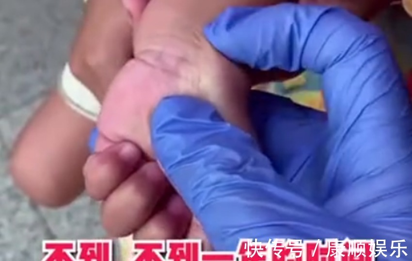 孩子|4岁萌娃手上长“蘑菇”,就医检查后,医生像变戏法,一按就没了