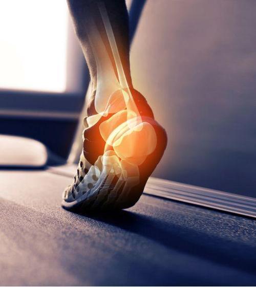  脊椎炎|怎么患上强直性脊椎炎，还会出现足跟痛吗？