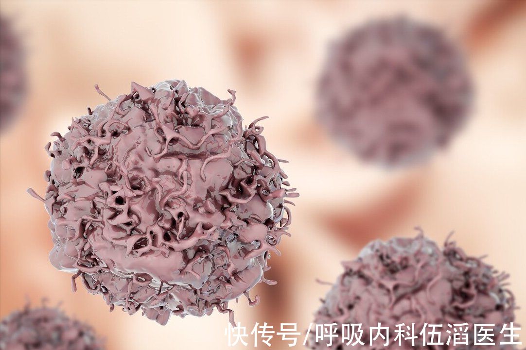 患癌|呼吸科医生提醒：这4类人易患上肺癌，要去做定期体检，排查病变